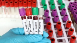 Ezt fontos tudni, ha ilyen a v�rcsoportod vesz�lyben lehetsz